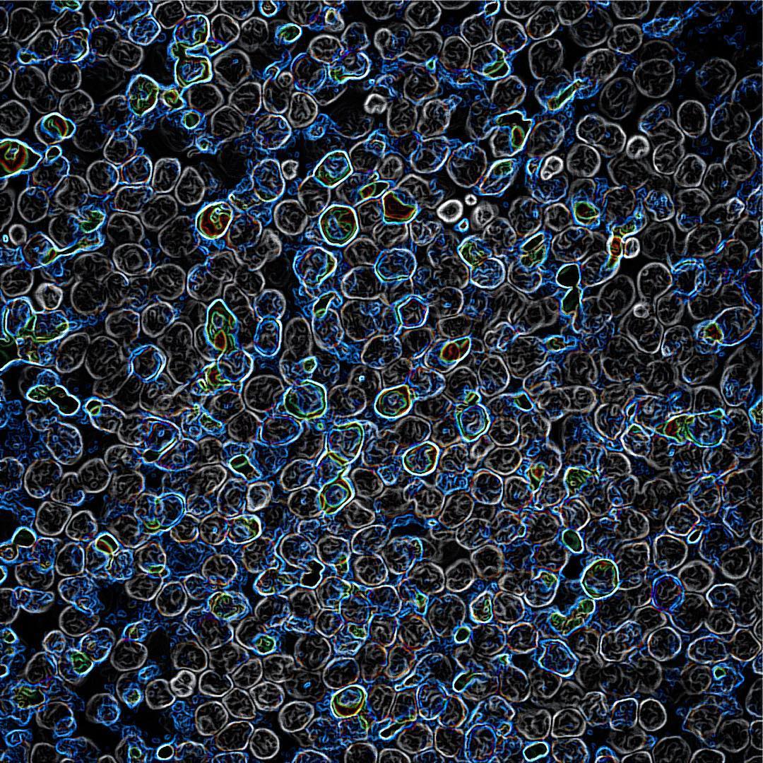Nelidova_confocal_microscopy_TRP_channel_transduced_human_photoreceptors_in_blue.jpg